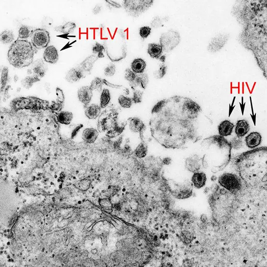 human t-cell lymphotropic virus 1&2 (htlv 1&2) test